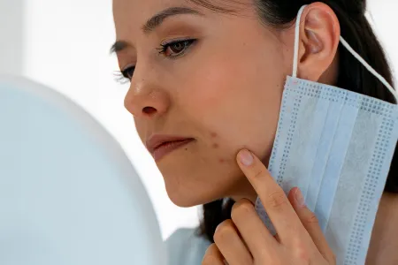 Maskné woman checking acne under her mask