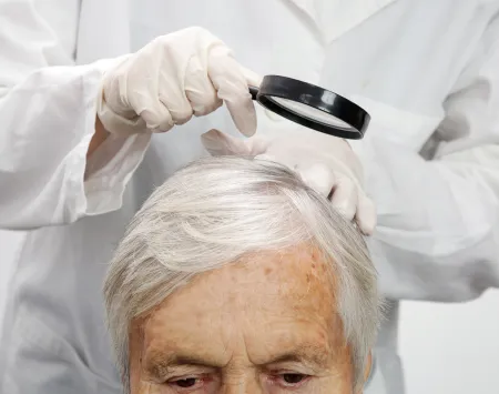 idős nő fejbőrének vizsgálata